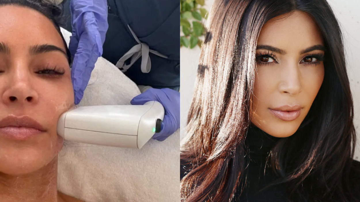 Perih Tapi Glowing! Kim Kardashian Habiskan Rp64 Juta untuk Perawatan Laser Jelang Met Gala