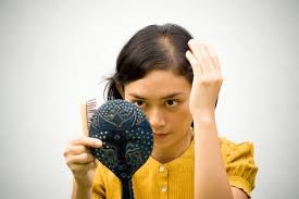 No More Insecure! Bongkar 5 Penyebab Kebotakan Dini Pada Wanita