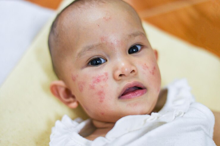 Jangan Anggap Remeh! Ini 6 Penyakit Berbahaya yang Bisa Menular Pada Anak Kecil Lewat Ciuman dan Sentuhan