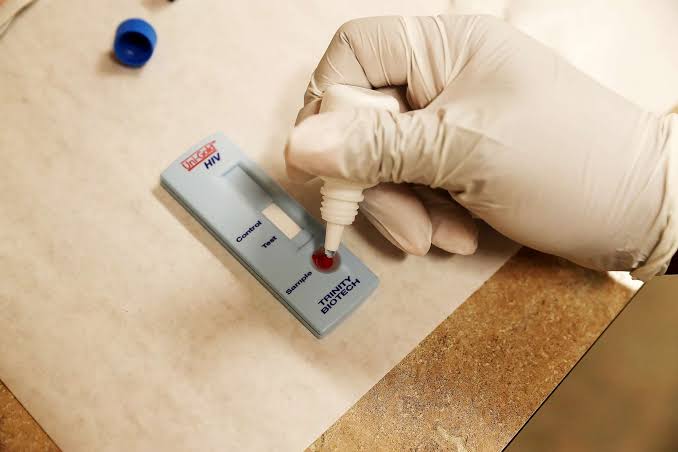 63% Kasus HIV di Indonesia Sudah Teridentifikasi, Pemerintah Gaspol Menuju Akhir Epidemi! 