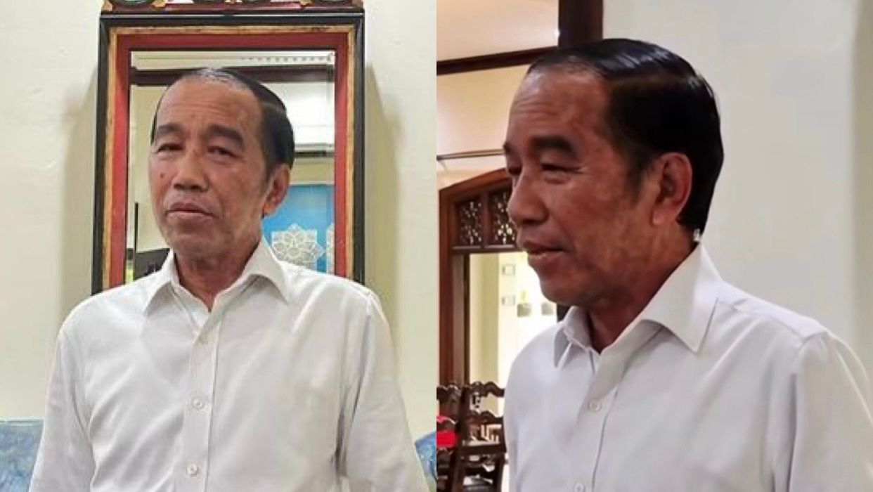 Kondisi Kulit Jokowi Jadi Sorotan Publik, Ini Penjelasan Mengenai Alergi Kulit