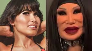 Tragis! Artis Seksi Ini Jadi Korban Filler Ilegal, Wajah Cantiknya Hancur Akibat Korban Teman Iri Hati!