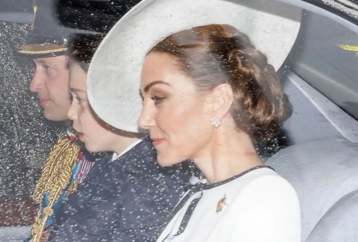 Ahli Bedah Plastik Ungkap Fakta di Balik Perubahan Wajah Kate Middleton: 'Ini Hanya Efek Aging Alami dan Makeup'!