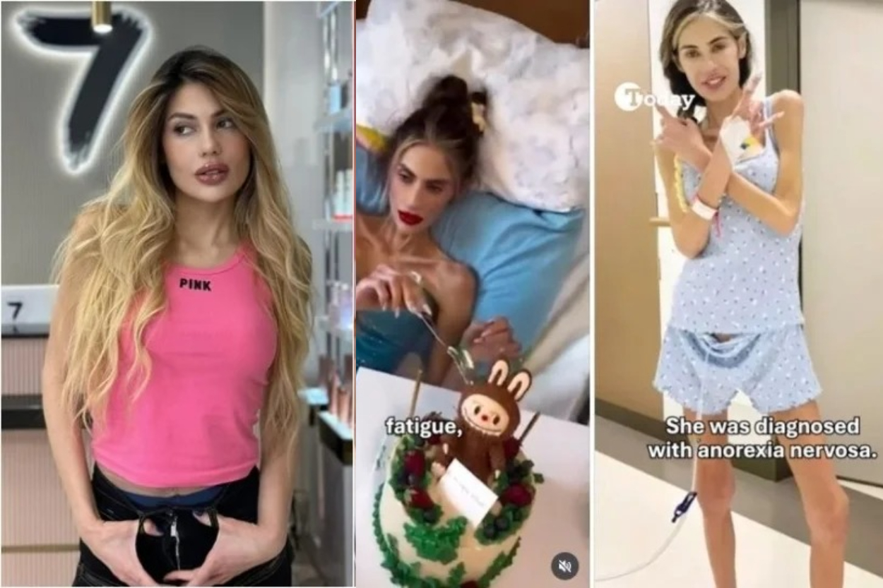 Terobsesi Kurus! Influencer Ini Meninggal Tragis Usai Diet Ekstrem, Turun 40 Kg hingga Berat Tinggal 23 Kg!