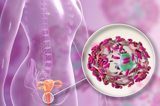 Waspada Miss V Gatal dan Bau? Bisa Jadi Kamu Kena Bacterial Vaginosis!