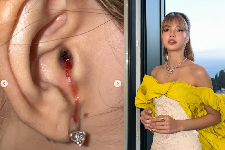 Lisa BLACKPINK Unggah Video ‘Telinga Berdarah’ Saat Liburan, Fans Langsung Panik!