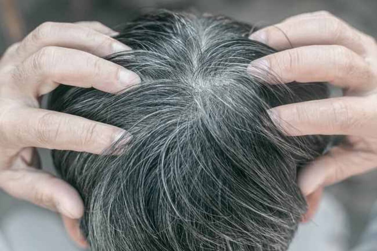 Mitos atau Fakta? Cabut Uban Bikin Tumbuh Lebih Banyak! Ini Penjelasan Ilmiahnya