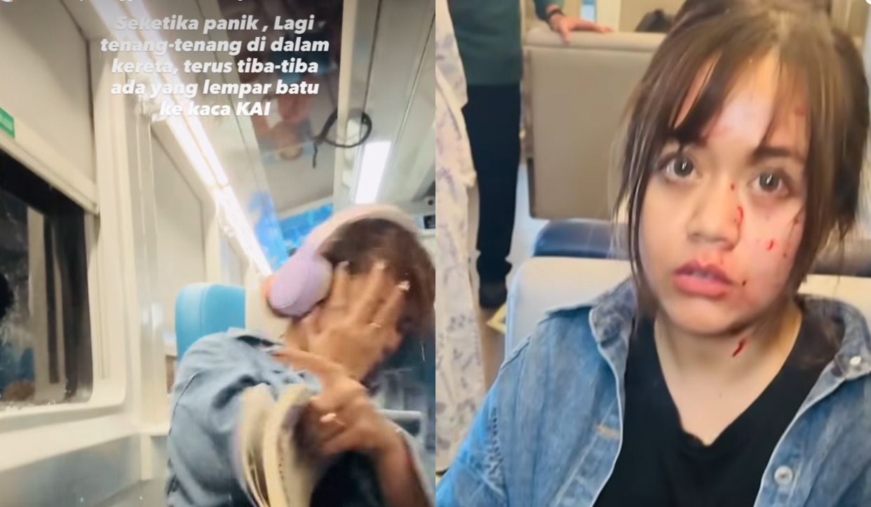 Detik Detik Wanita Luka Parah Kena Lemparan Batu di Kereta, Wajah dan Mata Penuh Pecahan Kaca!