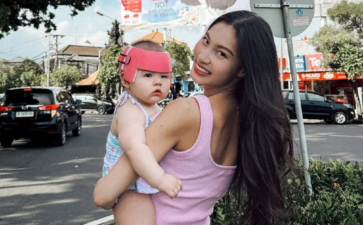 Anak Patricia Gouw Alami Kepala Peyang Parah, Harus Pakai Helm 23 Jam Sehari!