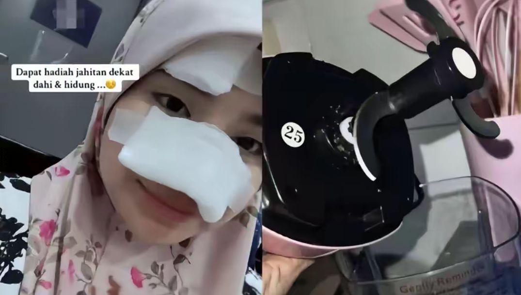 Tragis! Influencer asal Malaysia Alami Luka Serius Usai Gunakan Blender Portable di Rumah