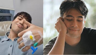 Ngeri! Vidi Aldiano Alami Perubahan Drastis karena Efek Samping Pengobatan Kanker