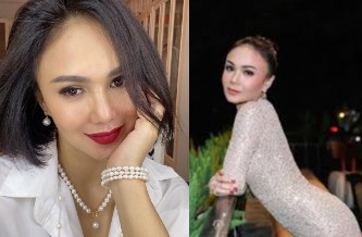 Bukan Tak Mau Ikut Tren, Yuni Shara Takut Operasi Plastik karena Punya Masalah ini