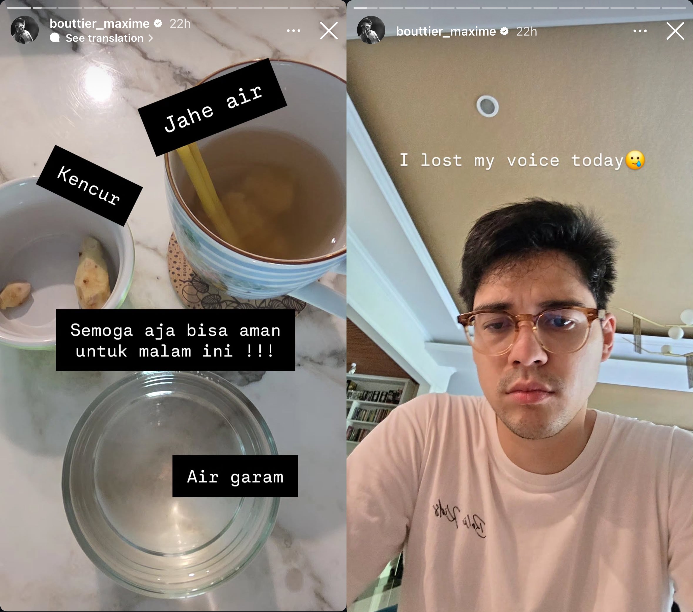 Resepsi Pernikahan Hampir Berantakan! Maxime Bouttier Alami Musibah Jelang Momen Bahagia dengan Luna Maya