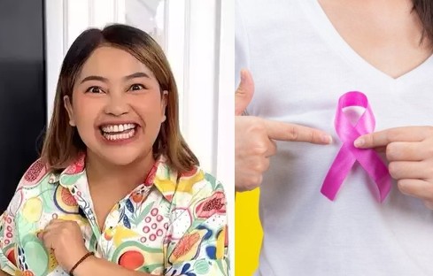 Belajar dari Mpok Alpa, Kanker Payudara Bisa Menyerang karena Keturunan! Begini Cara Mencegahnya