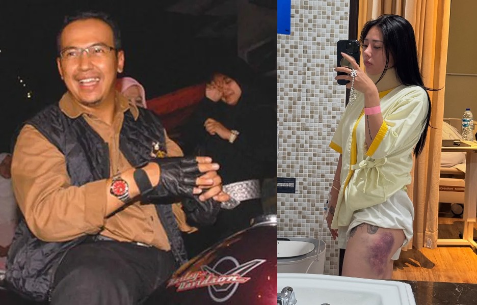 Ngeri! 3 Artis Indonesia Ini Celaka Saat Menjalani Hobi, Ada yang Tewas Tragis