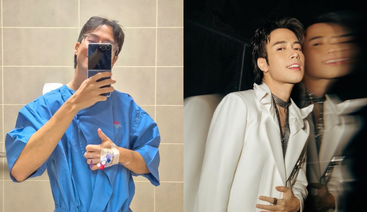 Vidi Aldiano Bantah Rumor Pakai Wig, Akui Kondisinya Tak Separah yang Ramai Diberitakan Publik