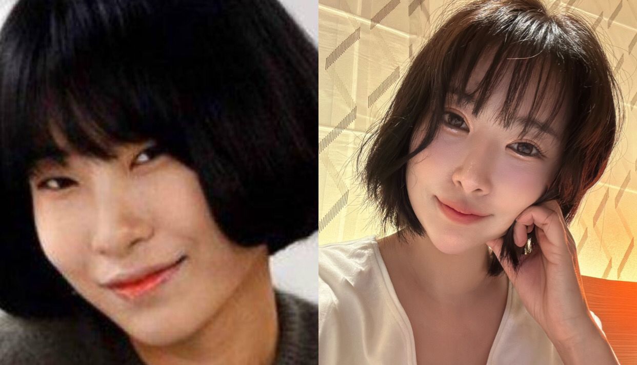 Lelah Fisiknya Selalu Dibully, Pemain Reply 1988 Lee Se Young Akui Habiskan Rp1,2 Miliar Untuk Oplas! 