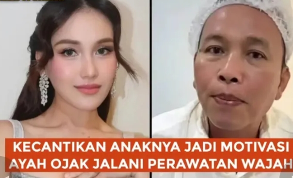 Ayah Ojak Habiskan Ratusan Juta Demi Kulit Glowing, Katanya Lebih Kinclong dari Ayu Ting Ting?