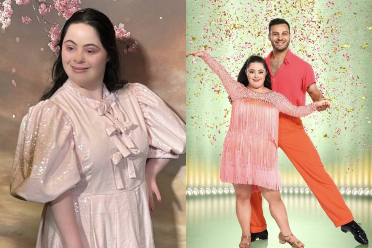 Kisah Ellie Goldstein: Model Down Syndrome yang Robohkan Batasan Dunia Fashion, Siap Guncang Panggung Hiburan Global!