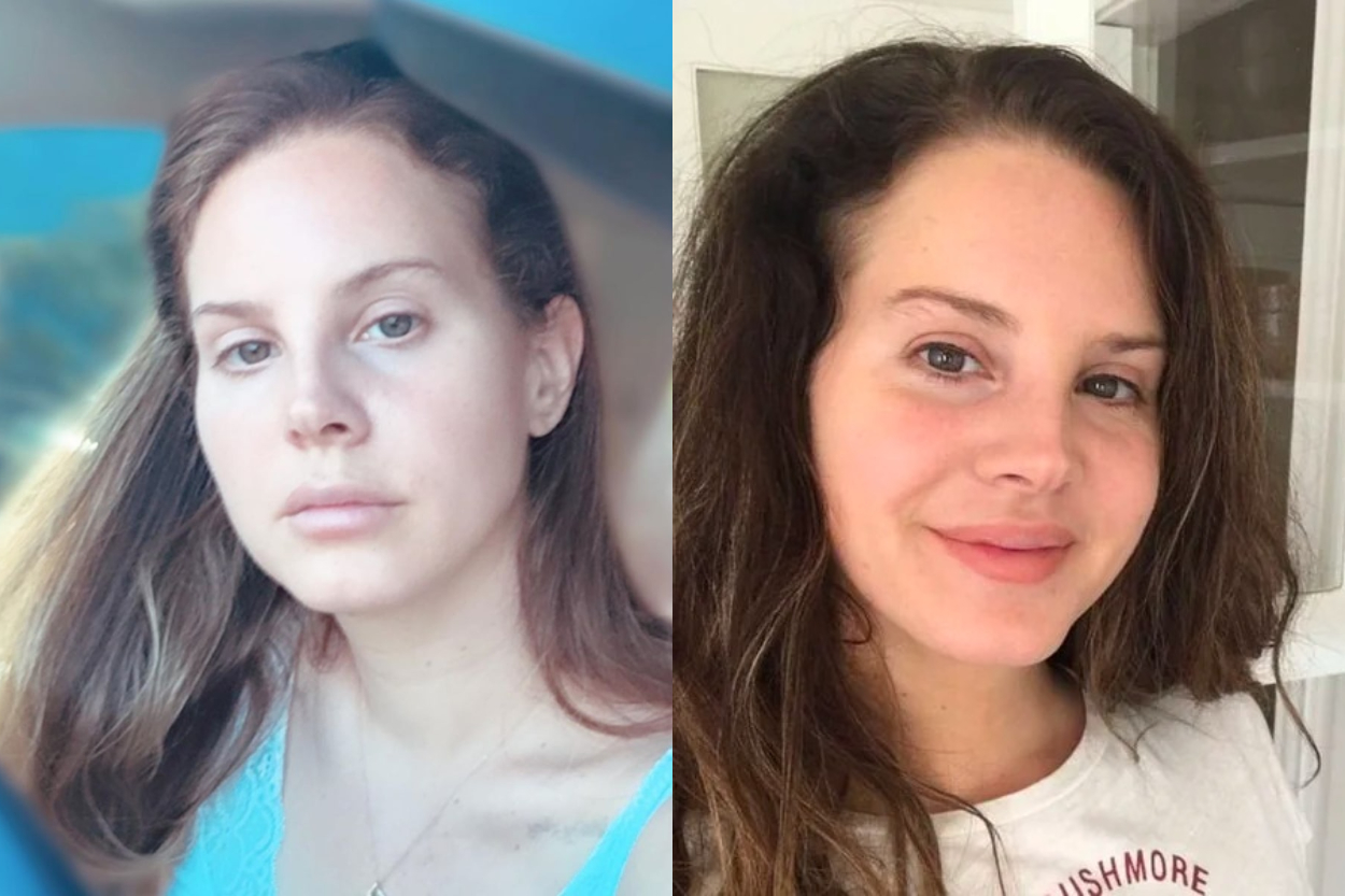 Bantah Operasi Plastik, Lana Del Rey Ungkap Rahasia Liquid Nose Job Hingga Bocorkan Album Baru