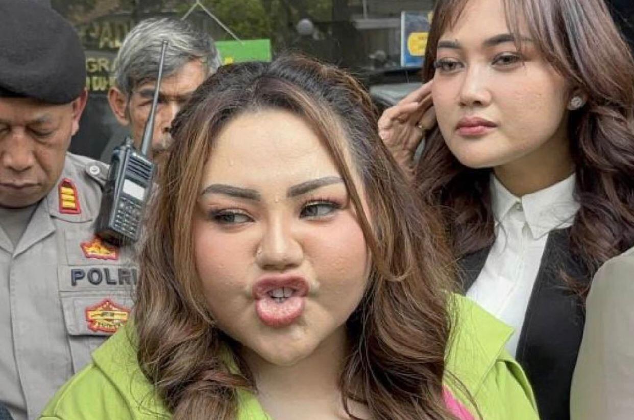 Lisa Mariana Rujuk dengan Suami Usai Jadi Tersangka Kasus Ridwan Kamil, Publik Terkejut