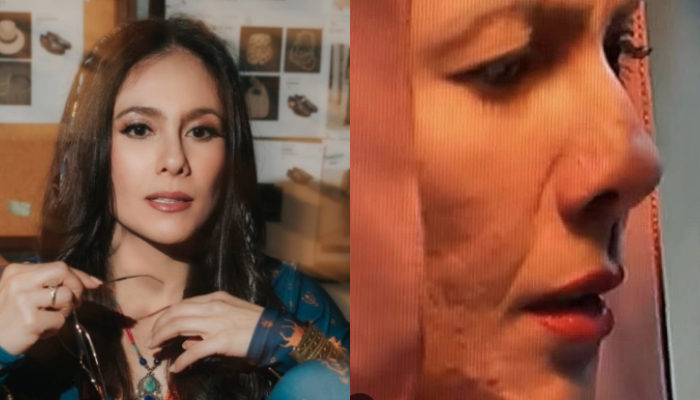 Wulan Guritno Buka Suara Usai Wajahnya Disebut Tak Mulus, Para Artis Auto Beri Dukungan