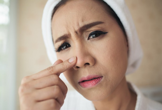 Cara Efektif Menghilangkan Close Komedo Membandel Secara Aman dan Alami