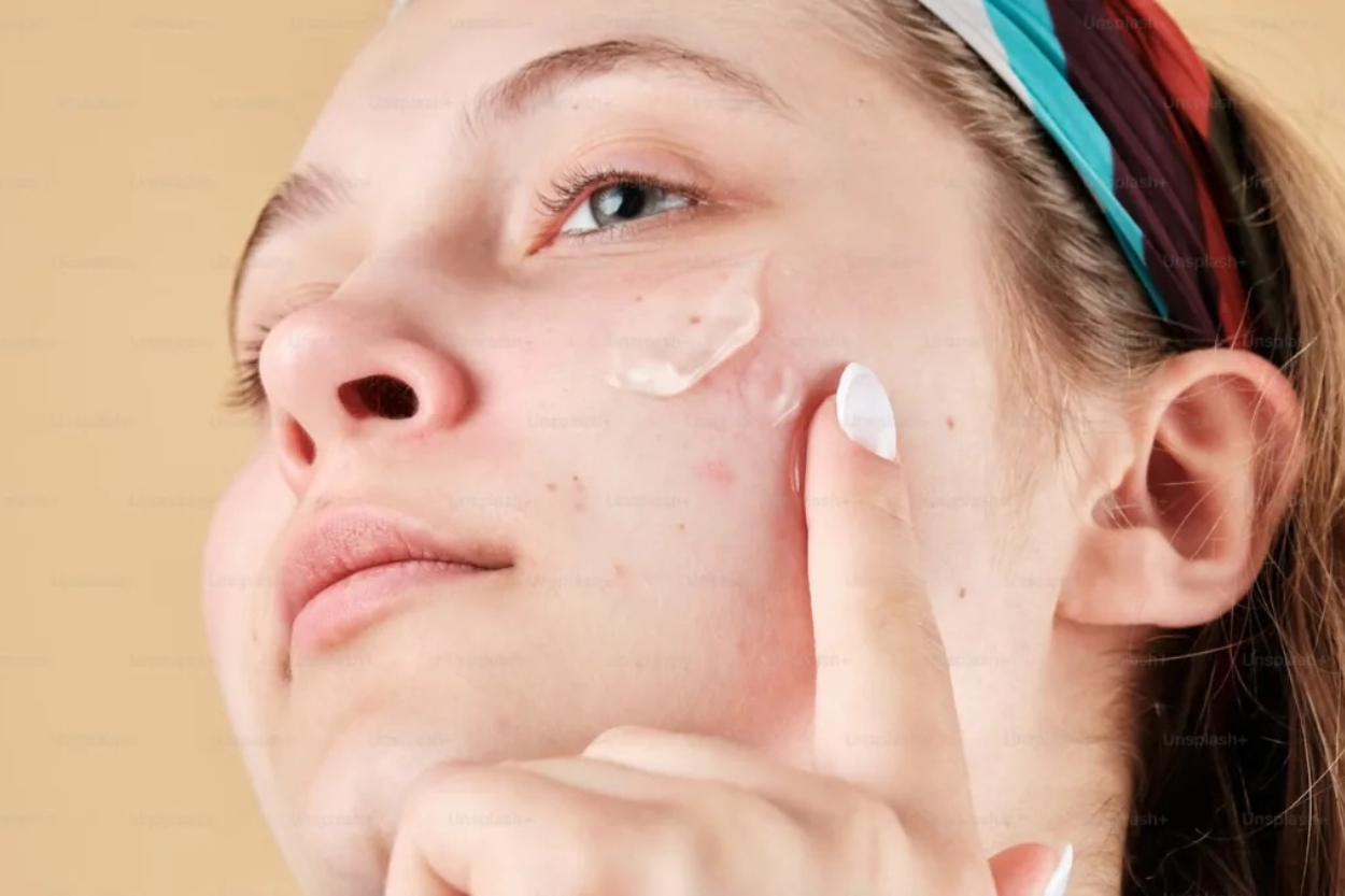 5 Rekomendasi Sunscreen Tone Up Non Comedogenic untuk Kulit Berjerawat, Ada Some By Mi!