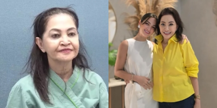 Penampilan Ibu Nia Ramadhani, Chanty Marcia Tuai Sorotan Pasca Operasi Plastik, Kian Cantik dan Kencang di Usia 65 Tahun