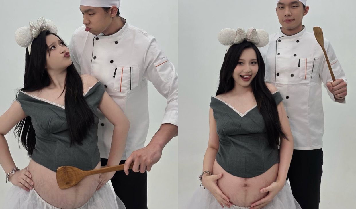 Unggahan Nita Vior Soal Stretch Mark Jadi Inspirasi Bumil, Ini Tips Mengatasinya Secara Alami