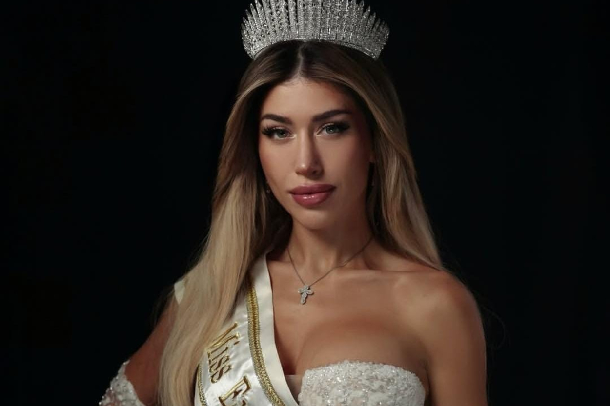 Miss Germany Diana Fast Pilih Mundur dari Miss Universe, Ini Alasan Menyentuh Dibaliknya