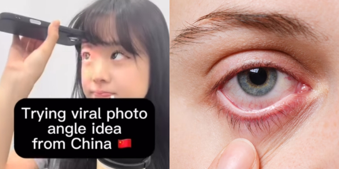 Waspadai Bahaya Tren Foto Mata Viral dari China, Bisa Sebabkan Iritasi Serius
