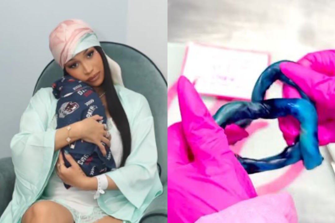 Baru Melahirkan, Cardi B Ubah Tali Pusar Anaknya Jadi Perhiasan Mewah Berlapis Emas