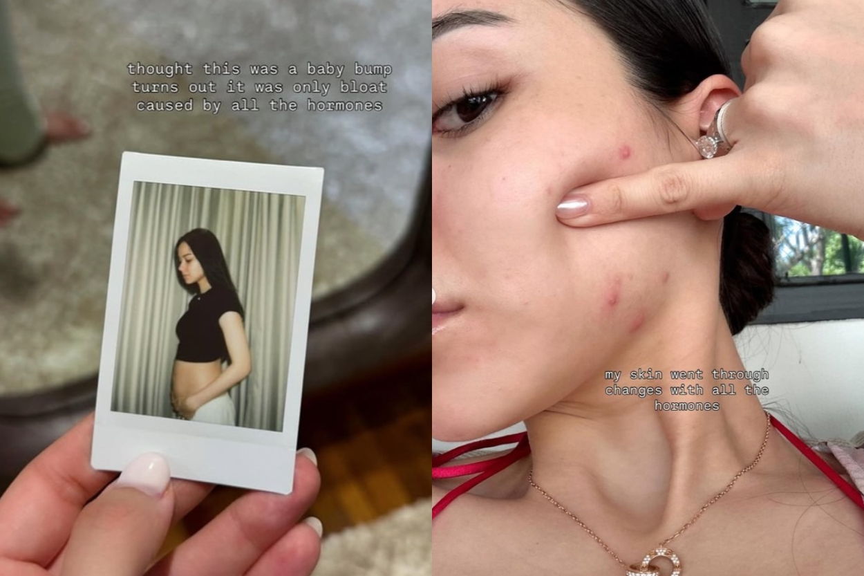 Alyssa Daguise Bongkar Drama Trimester Pertama Kehamilan: Mood Amburadul, Ngidam Aneh, hingga Pamer Jerawat!