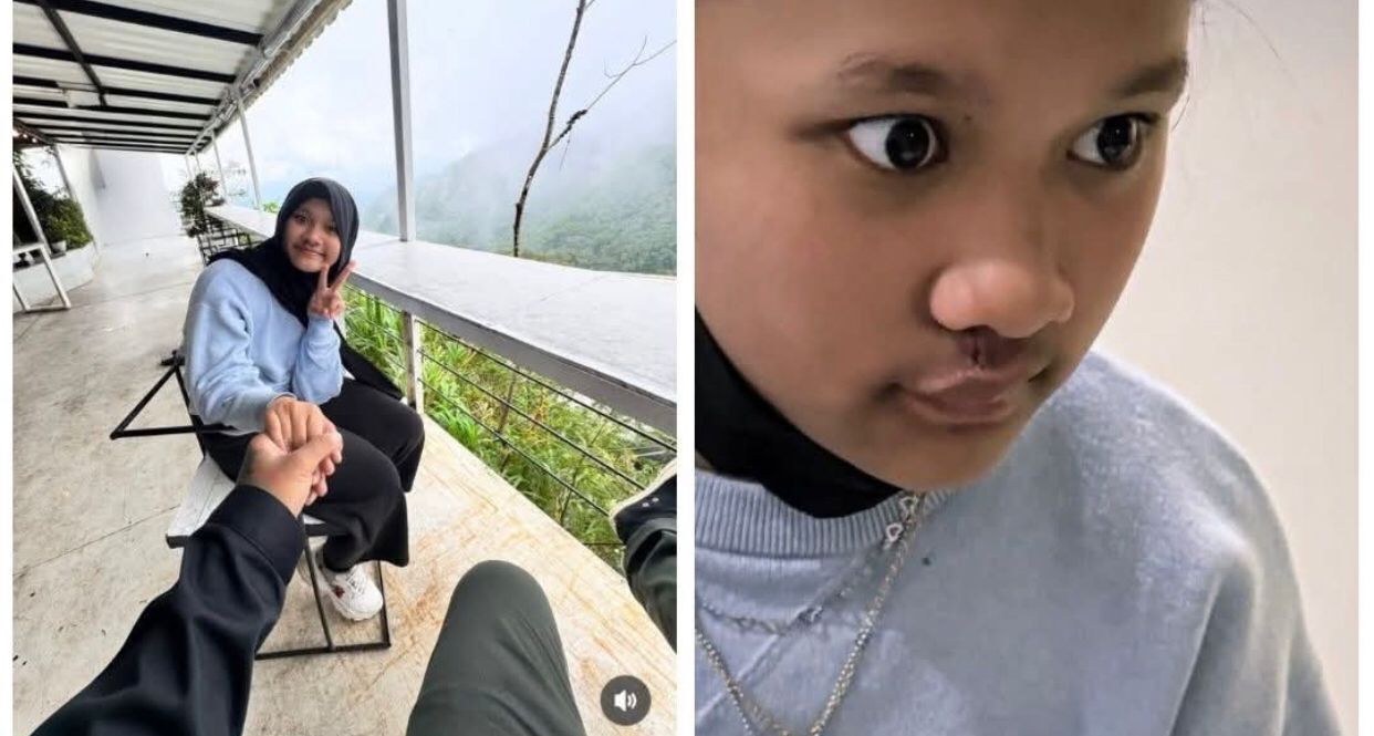Virgoun Unggah Potret Starla Tanpa Tanda Lahir, Warganet Ramai Beri Pujian