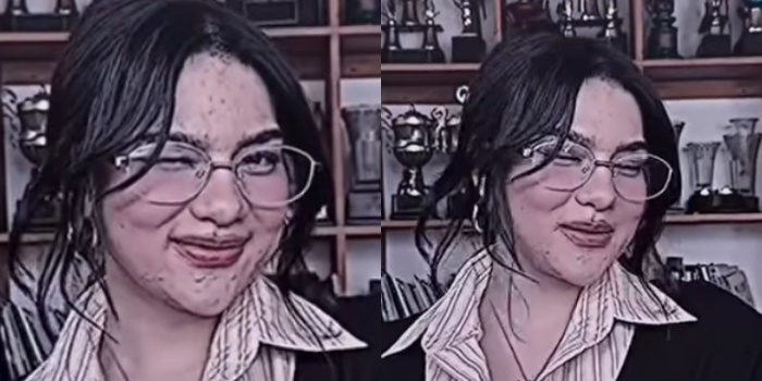 Viral Video Anyar Davina Karamoy dengan Wajah Penuh Jerawat, Dugaan Minum Pil KB Menguat