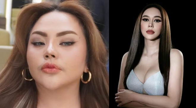 Adu Fasilitas dari Ridwan Kamil! Lisa Mariana Sindir Ketimpangan, Aura Kasih Meradang