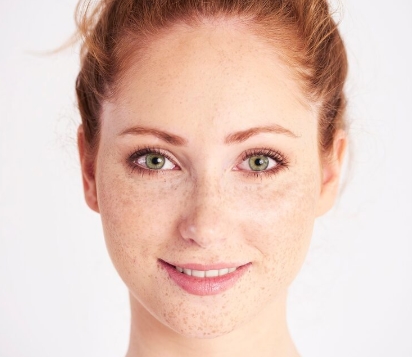 Apa Itu Beauty Freckles? Sempat Dianggap Menghalangi Kecantikan, Kini Justru Jadi Tren Dunia