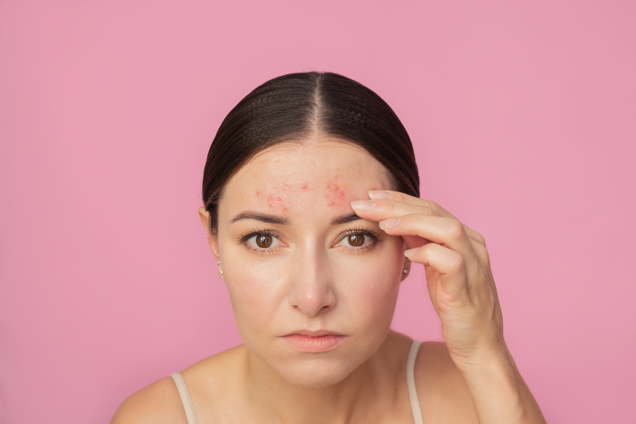 Jerawat Tak Kunjung Hilang? Stop Coba Cara Instan, Ini 7 Rangkaian Skincare yang Lebih Aman dan Efektif