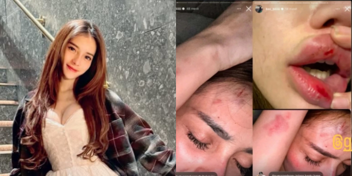 Profil Nabilla Aprillya, Mantan Pacar Atta Halilintar yang Kini Diterpa Isu KDRT Oleh Ketum Partai Ternama