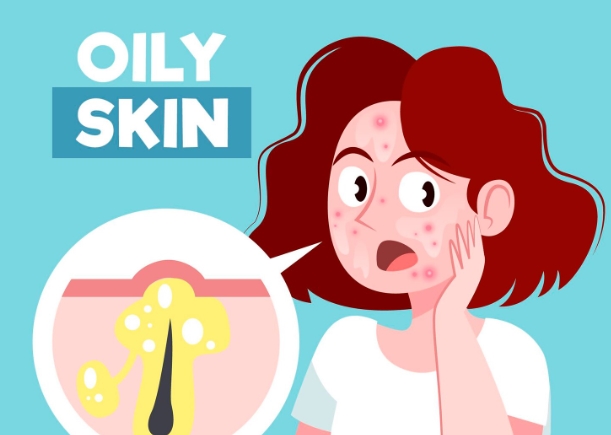 Kenapa Kulit Tetap Berminyak Meski Sudah Pakai Moisturizer? Berikut Penjelasannya