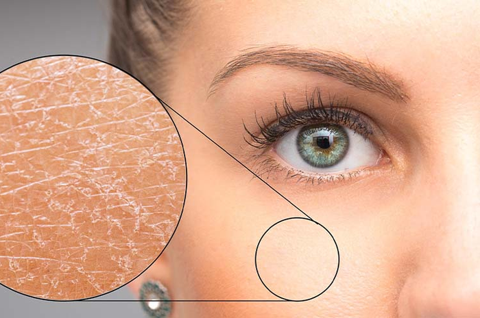 Skin Barrier Rusak? Ini 5 Kandungan Skincare yang Wajib Kamu Tahu!