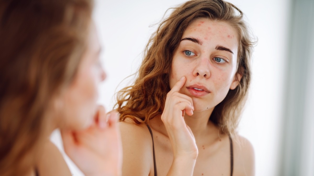 Bikin Insecure! Mengenal Skin Anxiety, Fenomena Skincare yang Menggerogoti Kepercayaan Diri Perempuan