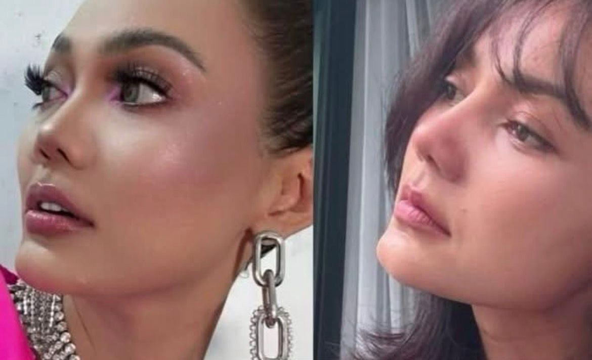 Sejumlah Artis Tampil Manglingi Usai Operasi Hidung, Ria Ricis Terbaru