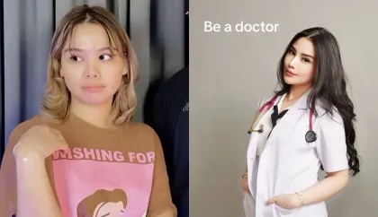 Wajah Cindy Rizap Dulu vs Sekarang Bikin Netizen Melongo: Kok Bisa Beda Banget?