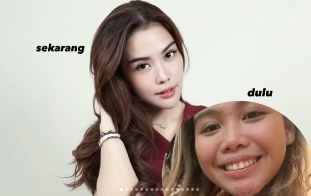 Aib Cindy Rizap Kesebar, Foto Before After Bikin Publik Gagal Fokus: Bak Bumi dan Langit