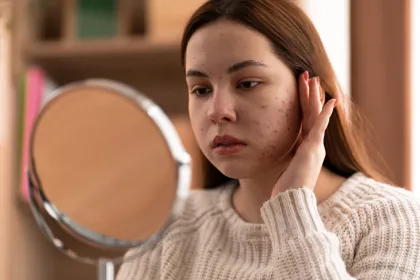 Tips Merawat Kulit Agar Tidak Breakout Menjelang Lebaran: Rahasia Glowing Saat Puasa