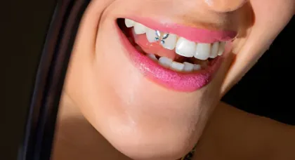 Tooth Gems Lagi Viral di Kalangan Gen Z! Hiasan Gigi Ini Bikin Senyum Makin Cantik atau Justru Berisiko?