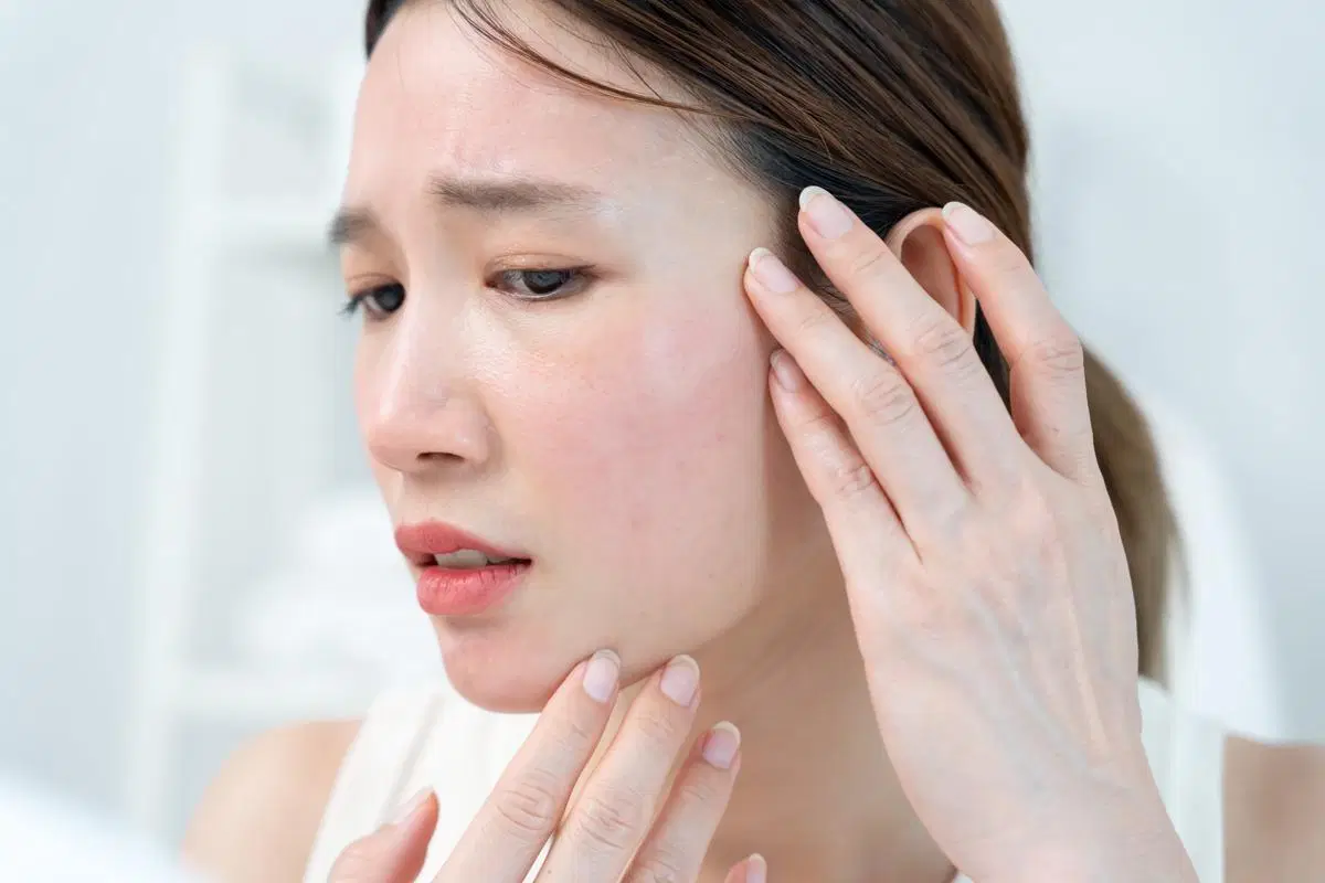 Nggak Semua Cocok, Ini 5 Efek Salah Pilih Moisturizer
