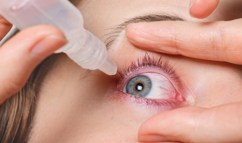 Mengenal Ablasio Retina, Penyakit Mata Serius yang Diduga Pernah Dialami Veri AFI hingga Harus Operasi